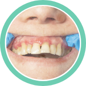 researchList_title_ico-01